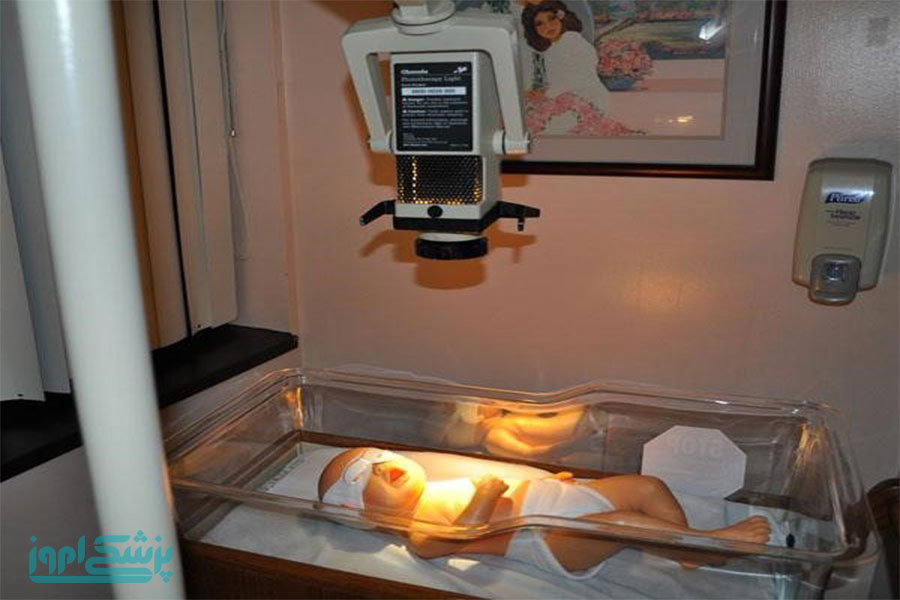 زردی| دستگاه زردی| نوزاد| پوست|لامپ‌های فوتوتراپی مبتنی بر هالوژن